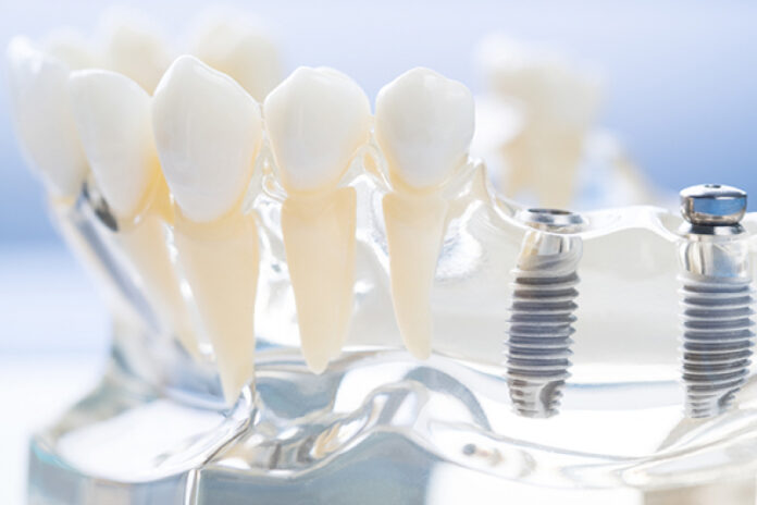 Australian-made dental implants