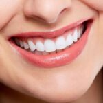 Revitalize Your Smile: The Ultimate Guide to Smile Makeovers