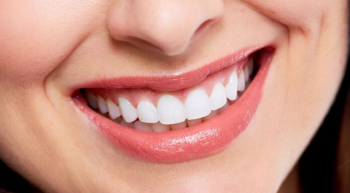 Revitalize Your Smile: The Ultimate Guide to Smile Makeovers Revitalize Your Smile: The Ultimate Guide to Smile Makeovers