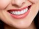 Revitalize Your Smile: The Ultimate Guide to Smile Makeovers Revitalize Your Smile: The Ultimate Guide to Smile Makeovers