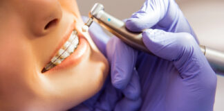 The Future of Orthodontics: Innovations on the Horizon Orthodontics