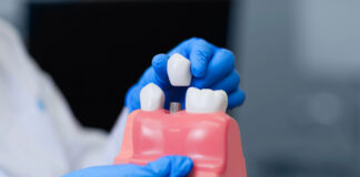 Are Dental Implants Right for You? Understanding the Procedure and Benefits dental implant